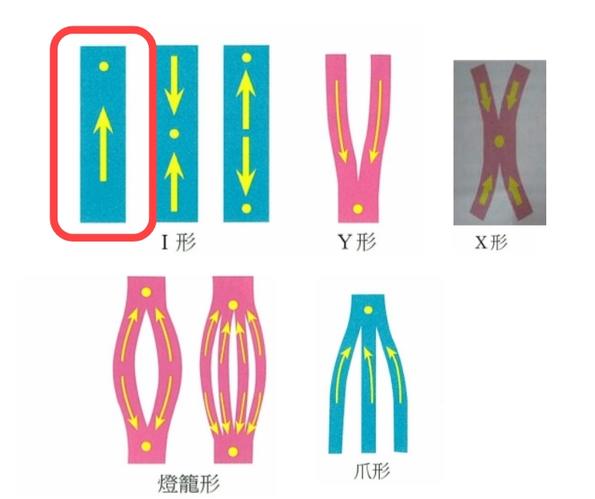 贴扎术3：腰疼的解决办法